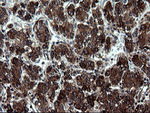 ARMC1 Antibody in Immunohistochemistry (Paraffin) (IHC (P))