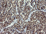 ARMC1 Antibody in Immunohistochemistry (Paraffin) (IHC (P))