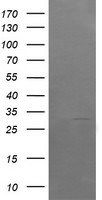 ARMC1 Antibody in Western Blot (WB)