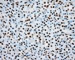 ARNT Antibody in Immunohistochemistry (Paraffin) (IHC (P))