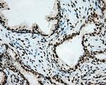 ARNT Antibody in Immunohistochemistry (Paraffin) (IHC (P))