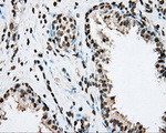 ARNTL Antibody in Immunohistochemistry (Paraffin) (IHC (P))