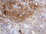 ARPC5 Antibody in Immunohistochemistry (Paraffin) (IHC (P))