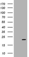 ARPC5 Antibody in Western Blot (WB)