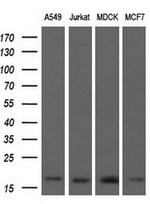 ARPC5 Antibody in Western Blot (WB)