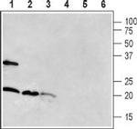 RAMP1 (extracellular) Antibody in Western Blot (WB)