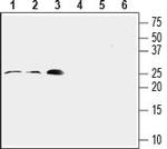 RAMP2 (extracellular) Antibody in Western Blot (WB)