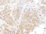 AS160 Antibody in Immunohistochemistry (IHC)