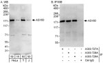 AS160 Antibody in Western Blot (WB)