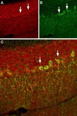 Pan NaV Antibody in Immunohistochemistry (IHC)