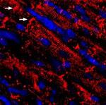 NaV1.5 (SCN5A) Antibody in Immunohistochemistry (Frozen) (IHC (F))