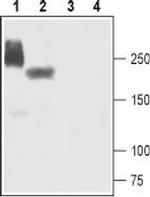 NaV1.5 (SCN5A) Antibody in Western Blot (WB)