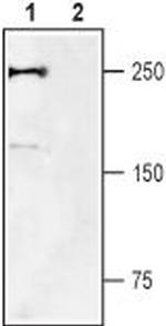 NaV1.7 (SCN9A) Antibody in Western Blot (WB)