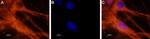 NaV1.6 (SCN8A) Antibody in Immunocytochemistry (ICC/IF)