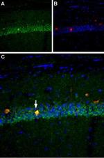 NaV1.6 (SCN8A) Antibody in Immunohistochemistry (IHC)