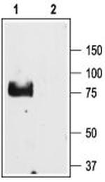 ENaC gamma (SCNN1G) (extracellular) Antibody in Western Blot (WB)