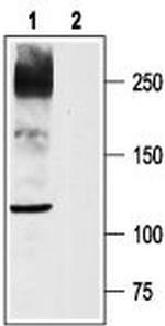 NaV1.8 (SCN10A) Antibody in Western Blot (WB)