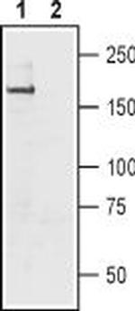 SCN11A (NaV1.9) Antibody in Western Blot (WB)