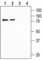 ENaC beta (SCNN1B) (extracellular) Antibody in Western Blot (WB)