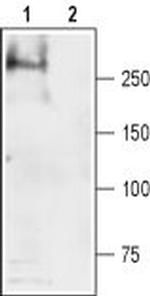 SCN4A (NaV1.4) Antibody in Western Blot (WB)