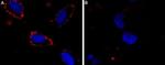 SCN3A (NaV1.3) (extracellular) Antibody in Immunocytochemistry (ICC/IF)