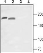 NaV1.8 (SCN10A) (extracellular) Antibody in Western Blot (WB)