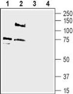 pan ASIC (extracellular) Antibody in Western Blot (WB)