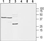 SCN1B (NaV beta 1) (extracellular) Antibody in Western Blot (WB)