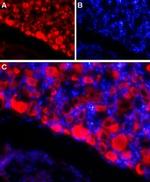 SCN4B (NaV beta 4) (extracellular) Antibody in Immunohistochemistry (IHC)