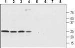 SCN4B (NaV beta 4) (extracellular) Antibody in Western Blot (WB)