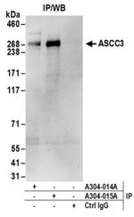 ASCC3 Antibody in Western Blot (WB)