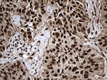 ASH2L Antibody in Immunohistochemistry (Paraffin) (IHC (P))