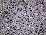 ASH2L Antibody in Immunohistochemistry (Paraffin) (IHC (P))