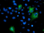 ASNS Antibody in Immunocytochemistry (ICC/IF)