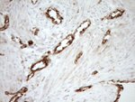 ASPDH Antibody in Immunohistochemistry (Paraffin) (IHC (P))