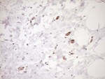 ASPDH Antibody in Immunohistochemistry (Paraffin) (IHC (P))