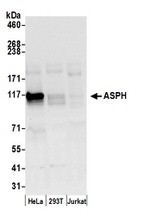 ASPH Antibody in Western Blot (WB)