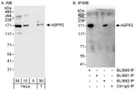 ASPP2 Antibody in Western Blot (WB)