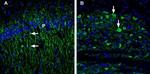 5HT1B Receptor (HTR1B) (extracellular) Antibody in Immunohistochemistry (IHC)