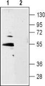 5HT1B Receptor (HTR1B) (extracellular) Antibody in Western Blot (WB)