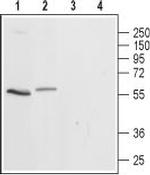 5HT3A Receptor (HTR3A) Antibody in Western Blot (WB)