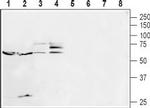 5HT2B Receptor (HTR2B) (extracellular) Antibody in Western Blot (WB)