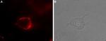 5HT4 Receptor (HTR4) (extracellular) Antibody in Immunocytochemistry (ICC/IF)