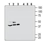 5HT7 Receptor/HTR7 (extracellular) Antibody in Western Blot (WB)