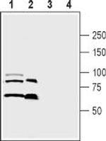 Semaphorin 3A (SEMA3A) Antibody in Western Blot (WB)