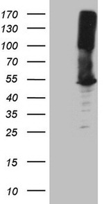 ASS1 Antibody in Western Blot (WB)