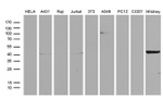 ASS1 Antibody in Western Blot (WB)