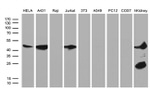 ASS1 Antibody in Western Blot (WB)