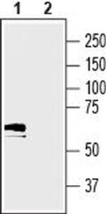 SLC17A5 (Sialin) Antibody in Western Blot (WB)