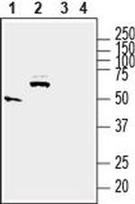 SLC17A5 (Sialin) Antibody in Western Blot (WB)